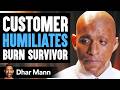 Customer Humiliates Burn Survivor, INSTANTLY REGRETS IT! | Dhar Mann