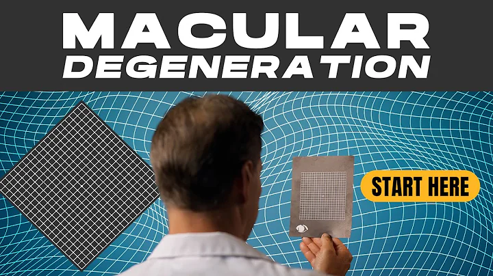 What You Need To Know About Macular Degeneration
