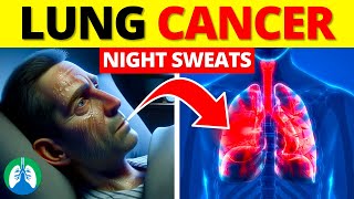 Night Sweats and Lung Cancer 😰 by Respiratory Therapy Zone 1,628 views 3 weeks ago 3 minutes, 26 seconds