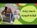 هل تحتاج إلى نظام غذائي خاص بعد عملية الزائدة الدودية الحقيقة الكاملة