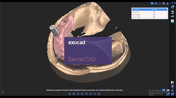 DOF ScanApp Tips - Instant Transition from ScanApp to Exocad