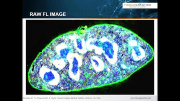 Advancing Tissue Cytometry from Image to Results with TissueGnostics and FCS Express