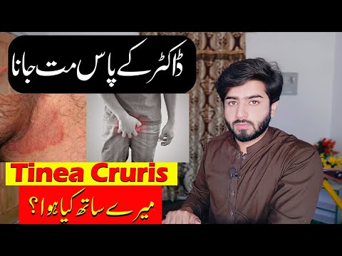 Private Part itching | Tinea Cruris | Fungle Infection | Babar Ali Hashmi