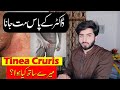 Private Part itching | Tinea Cruris | Fungle Infection | Babar Ali Hashmi