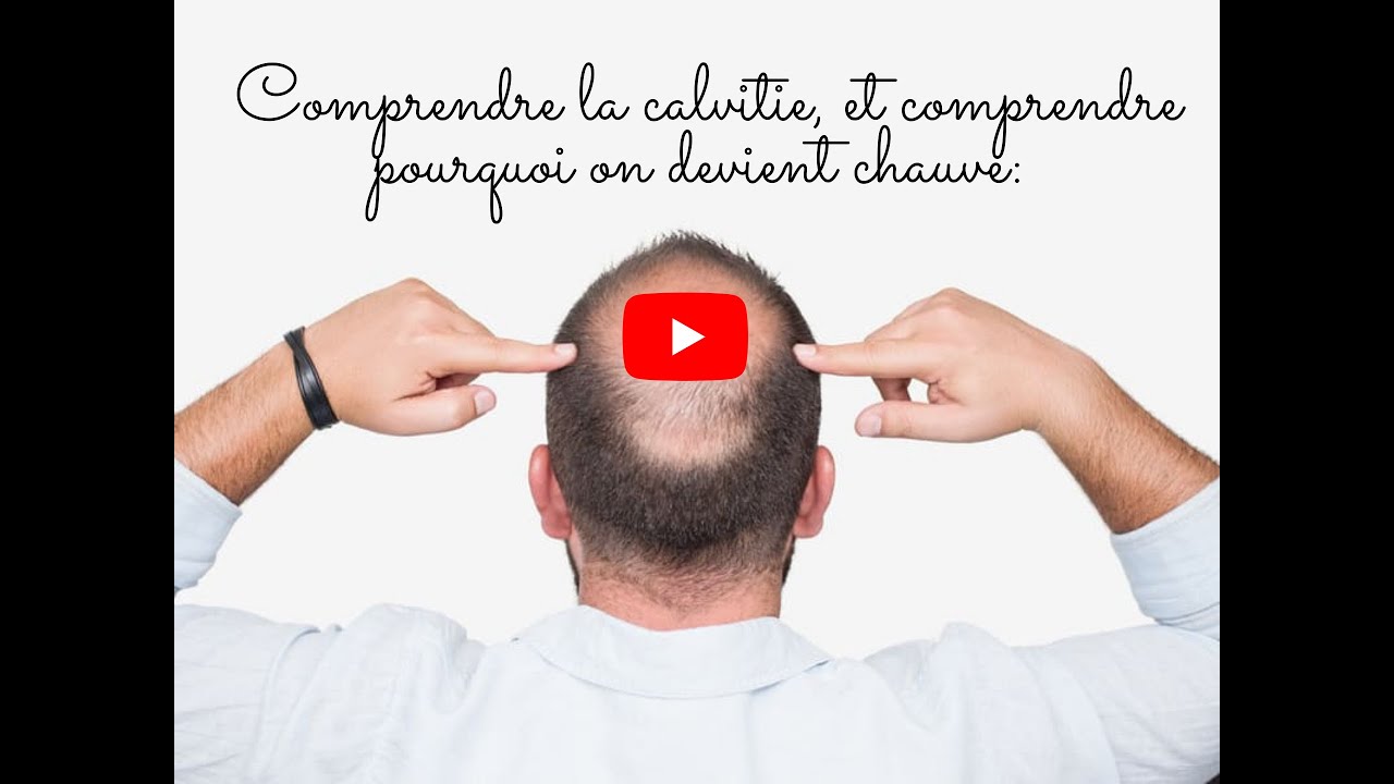 Alopécie / calvitie ; Comment prévenir la calvitie et comment pourrait — free download