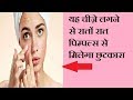 How To Remove Pimples Overnight
