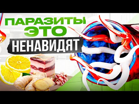 Еда от паразитов! 7 продуктов, которые глисты ненавидят