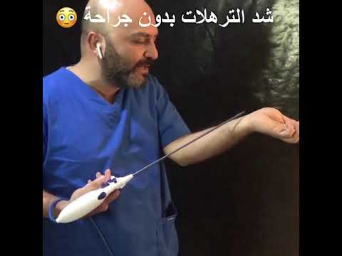 احدث تقنية في العالم شد الجسم بدون جراحة بتقنية الشد الايوني
