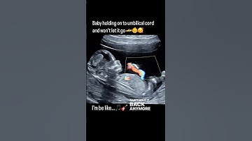 12 weeks baby pregnancy ultrasound fetus holding umbilical cord loop sonography