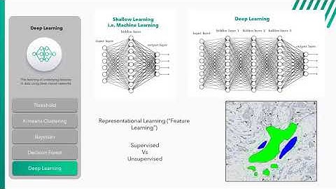 Artificial Intelligence in Digital Pathology