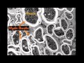 Myelin, the brain s high speed upgrade