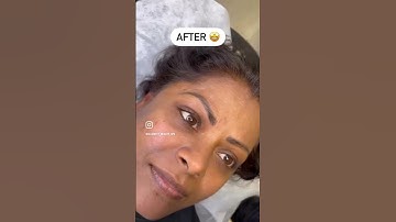 Nano brows before and after a six week touch up 🔥#Nanoblading #NanoBrows #MachineHairStrokes