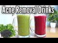 Acne, Pimple, Marks Removal & Skin Whitening Drink, Clear Skin with Homemade Drink, Urdu Hindi