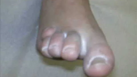 Come si chiama il primo dito del piede?