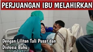 PROSES MELAHIRKAN NORMAL ANAK PERTAMA -  PERSALINAN DENGAN LILITAN TALI PUSAT