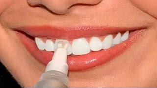 Отбеливание зубов смертельный номер! видео отбеливатель зубов