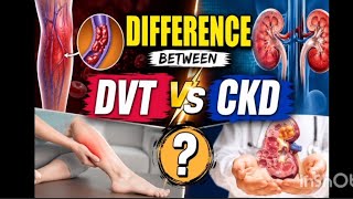 DVT n CKD
