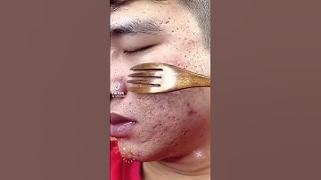 Thumbnail of Face  Cleansing