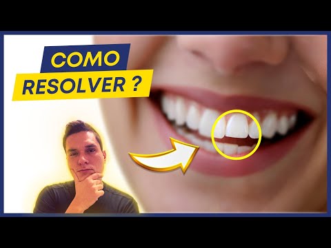 DENTE MAIOR DO