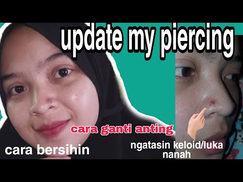 Video: Hidung Piercing Bump: Cara Menghilangkannya