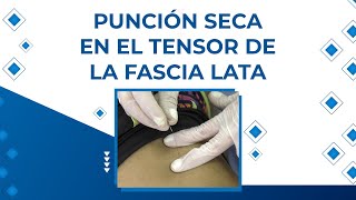 Punción Seca en el Tensor de la Fascia Lata