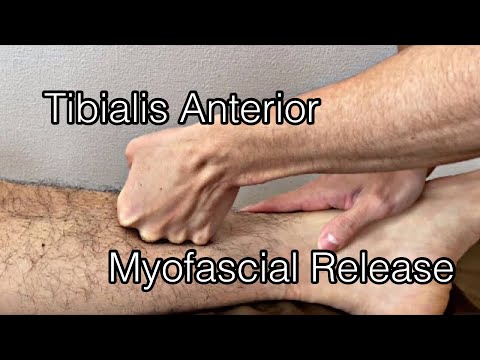 Video: Cara Melakukan Pijat Diri Rilis Myofascial untuk Shinsplints