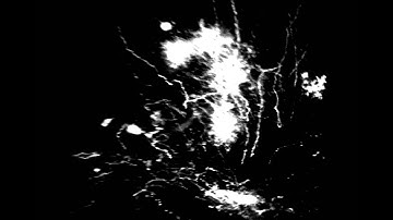 Cells in mouse brain shown with green fluorescence