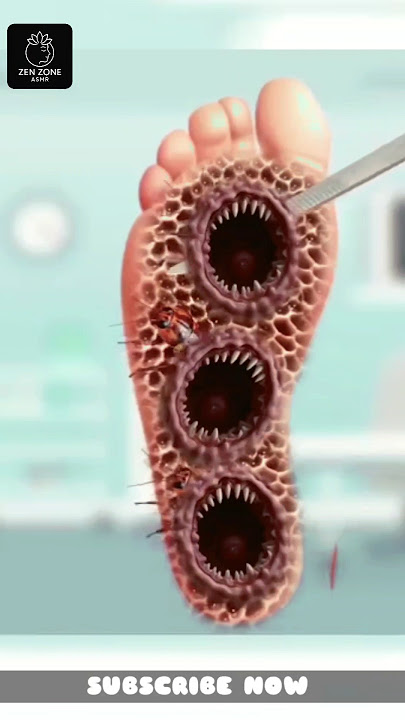 FOOT DEEP CLEANING | ASMR CLEANING VIDEOS | ASMR TREATMENT | BODY CLEANING | ASMR ANIMATION