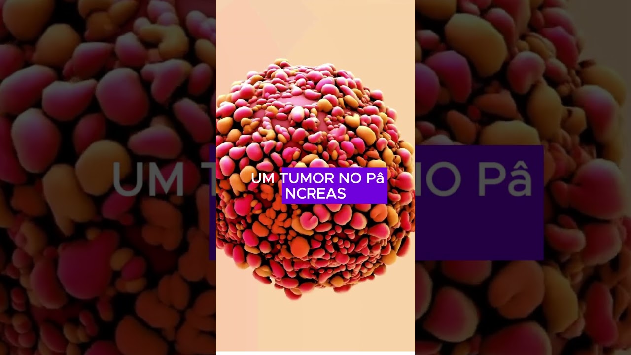 Câncer de pâncreas #curiosidades #cancer