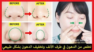 👃 كيفية التخلص من دهون الأنف ودهون أطراف الأنف ودهون أجنحة الأنف بشكل طبيعي