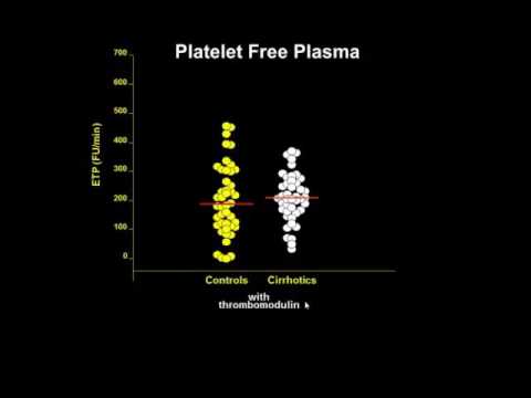 Prof. Mannucci - Coagulazione nel paziente cirrotico