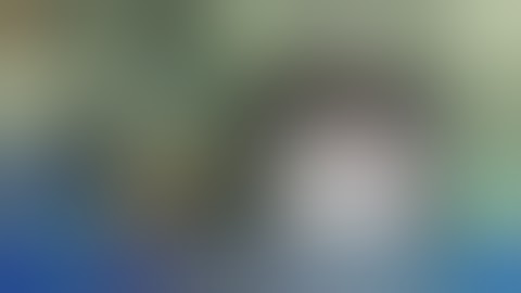 Nâng Cấp Vòng 1 Túi Motiva Nano Chip Ergonomix Size 300cc - 315cc - Dr.Tống Hải - Thẩm Mỹ Như Hoa