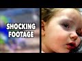 SHE TOOK A MAJOR HIT TO THE HEAD (Shocking Footage) | Dr. Paul