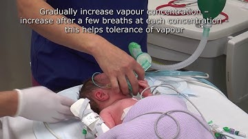 Paediatric Anaesthetics: Chapter 1 - Inhalational induction neonate