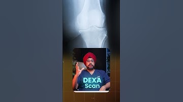 What is a DEXA Scan Test? Bone Density | Bone Strength #shorts
