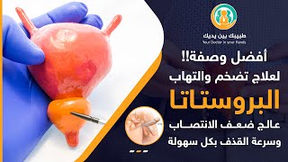 أفضل وصفة لعلاج تضخم والتهاب البروستاتا والتخلص من سرعة القذف وضعف الانتصاب نهائيآ 