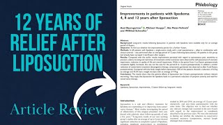 Lipedema Improvement 12 Years After Liposuction  Plastic Surgeon Reviews Article