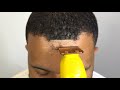 Worlds Hardest Hairline