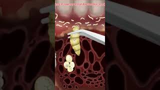 #shorts,#suvo,internal mouth ulcer treatment review helping 3D animation,#doctor #new #facts ,
