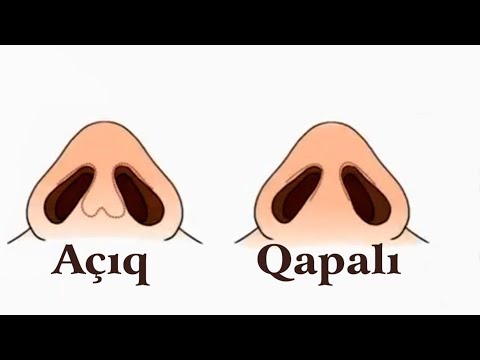 Video: Otologiya ilə otorinolarinqologiyanın fərqi nədir?