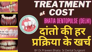 दांतो की हर प्रक्रिया के खर्च -Cost of every dental treatment AT Bhatia Dentopule(DELHI) #teethcost