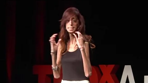 How do you define yourself? | Lizzie Velasquez | TEDxAustinWomen