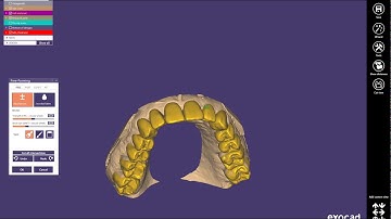 EXOCAD EXPERT _ How to create a WAXUP case