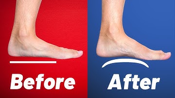 How to Fix Flat Feet | 3 SIMPLE Exercises from a Physical Therapist