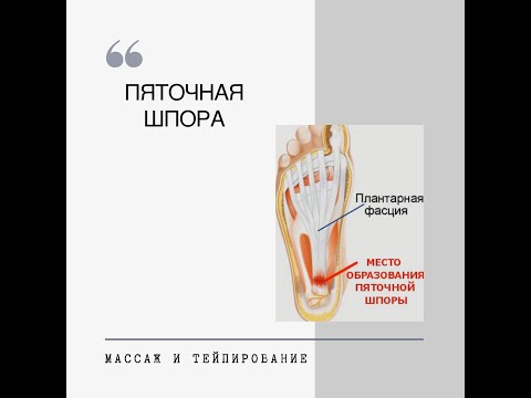 Фасциальный Массаж при пяточной шпоре
