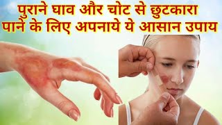 पुराने घाव और चोट से छुटकारा पाने के लिए अपनाये ये आसान उपाय//How to cure cut and wound instantly