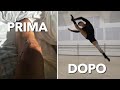 Ho scoperto di non poter danzare mai più