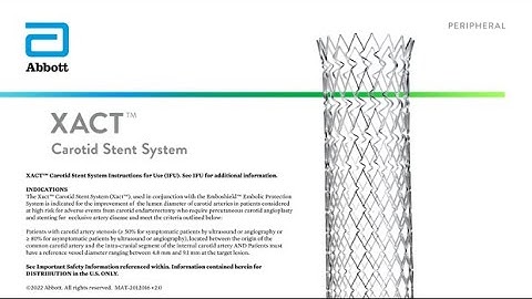 US XACT Carotid Stent System Prep & Deployment Video