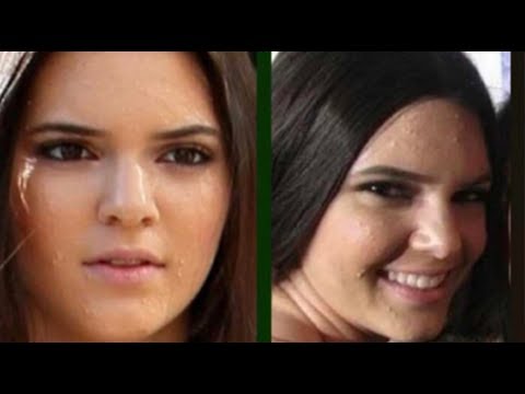 Video: You Will Not Believe What Kendall Jenner Uses To Fight Acne