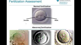Embryo Selection and Transfer - Mass General Fertility Focus Webinar